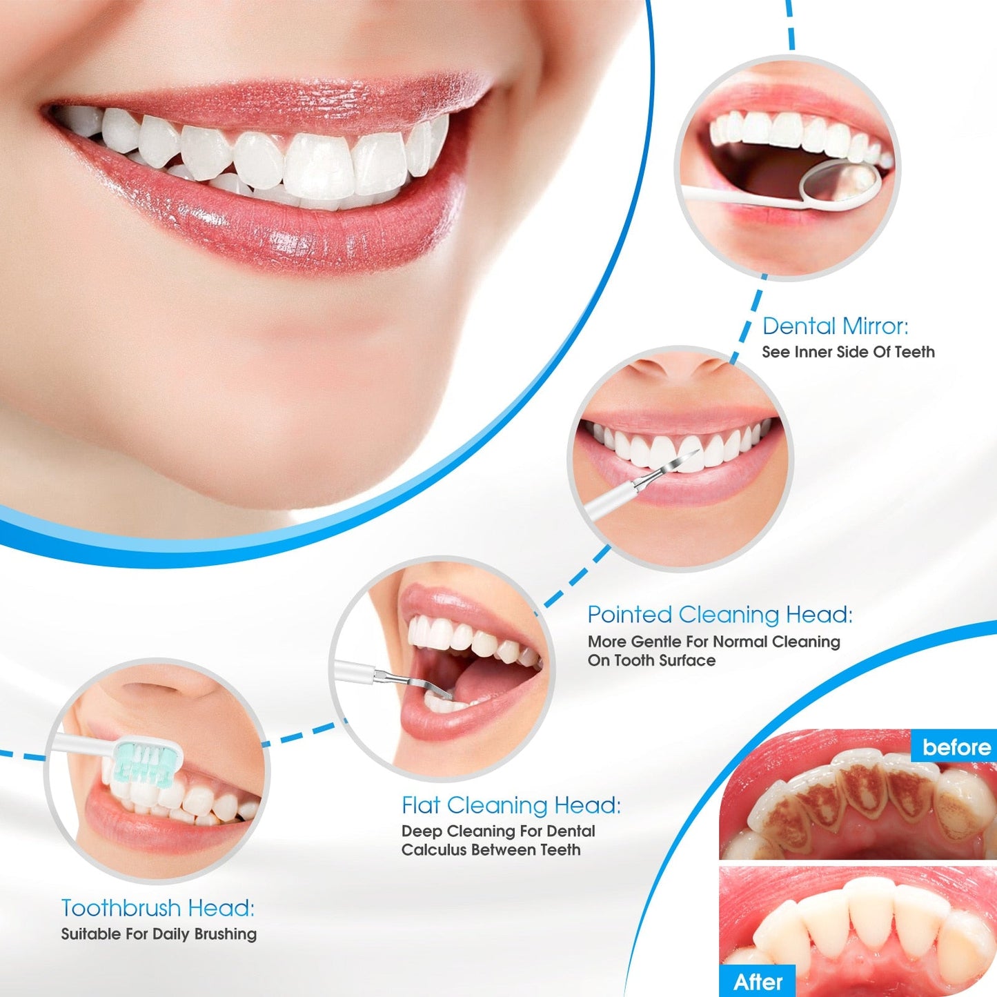 Oral Smile™ Electric Teeth Cleaner 6 In 1